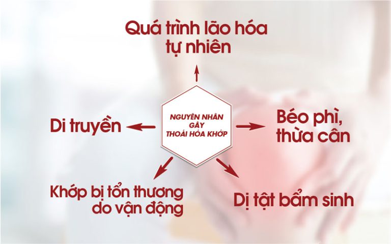 nguyen nhan gay thoai hoa khop