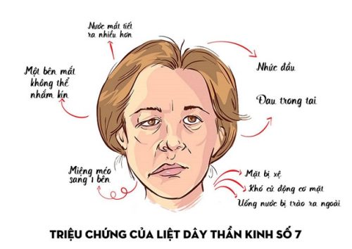 trieu chung liet vii ngoại biên