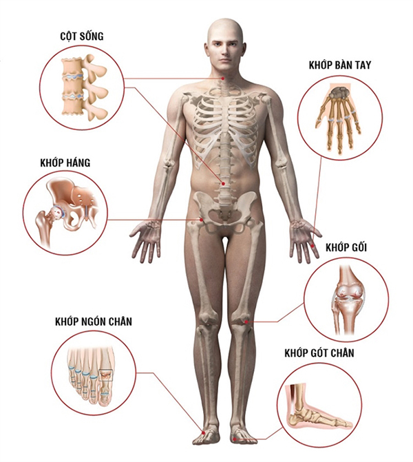 vị trí các khớp dễ bị thoái hóa