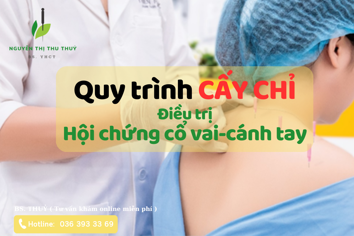 dieu tri dau co vai bang cay chi