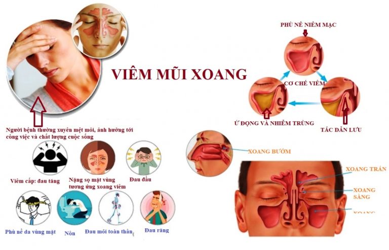 viem mui xoang