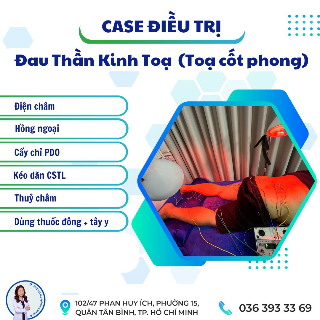 điều trị đau thần kinh toạ