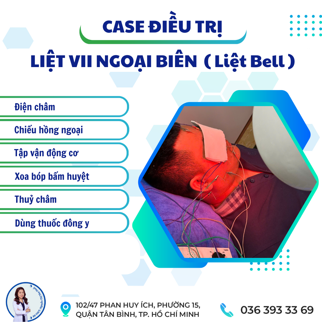 CASE ĐIỀU TRỊ liet