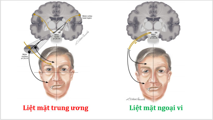 phan biet liet day than kinh vii trung uong va liet day vii ngoai vi